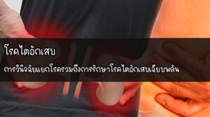 โรคไตอักเสบ